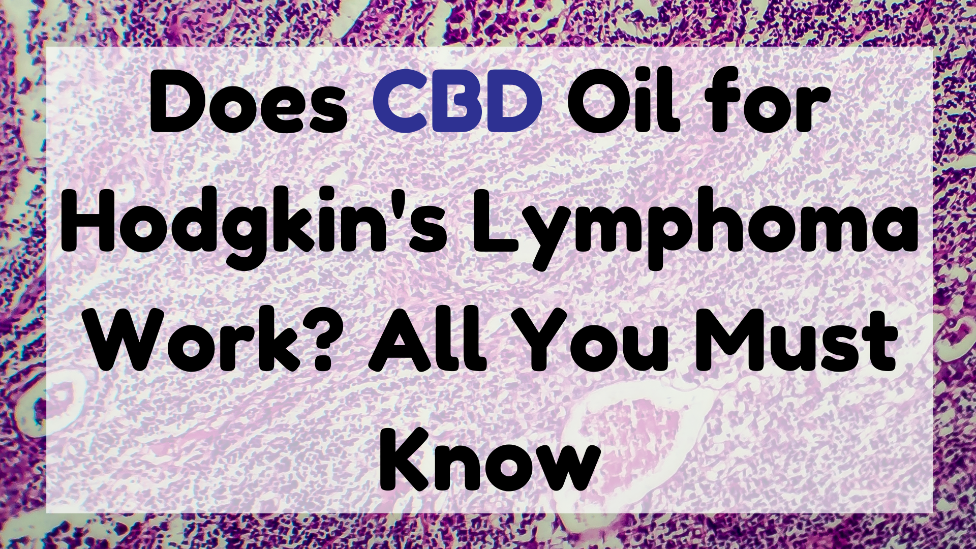 CBD Oil for Hodgkin's Lymphoma