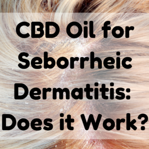CBD Oil for Seborrheic Dermatitis