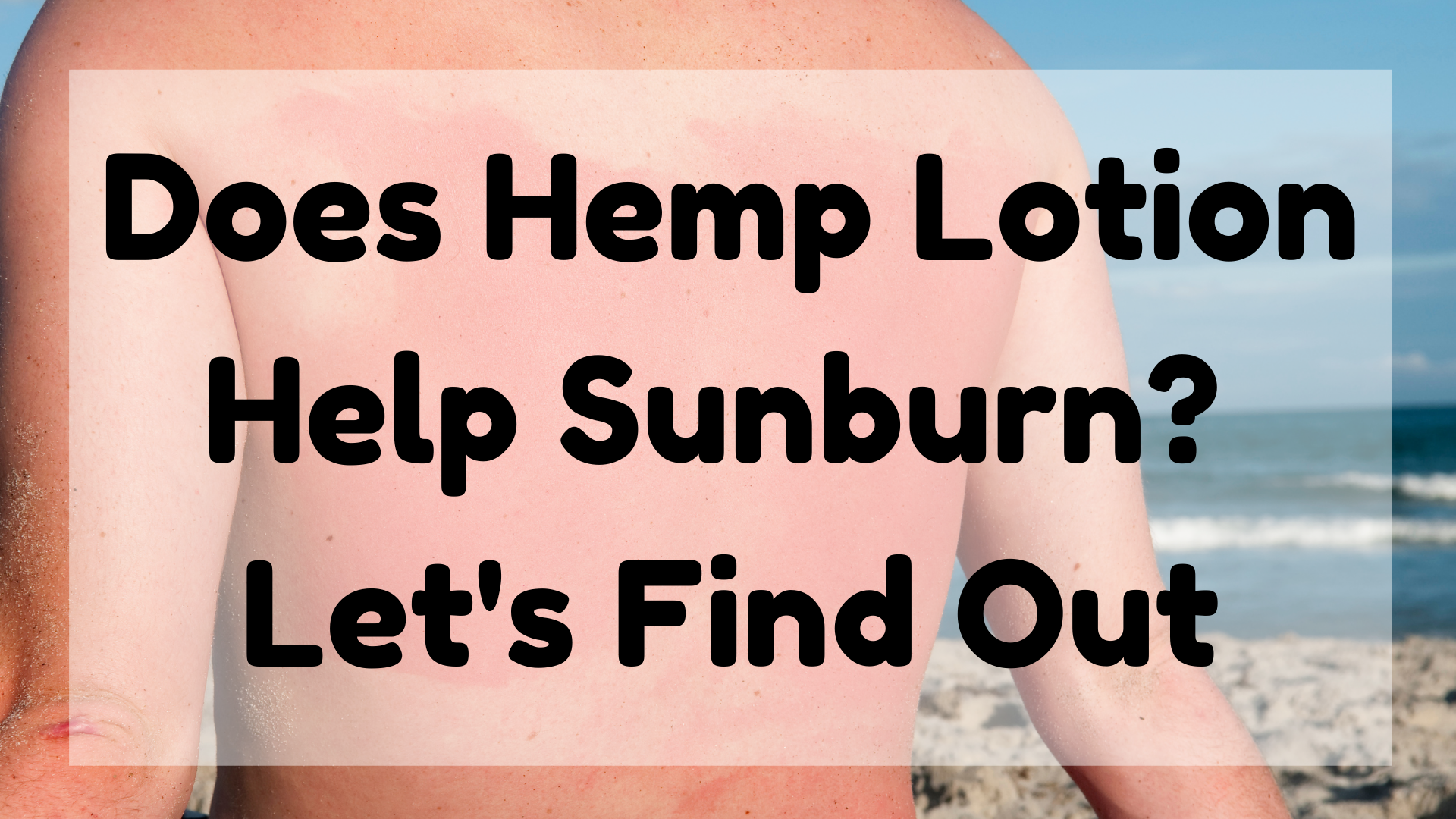 Does Hemp Lotion Help Sunburn